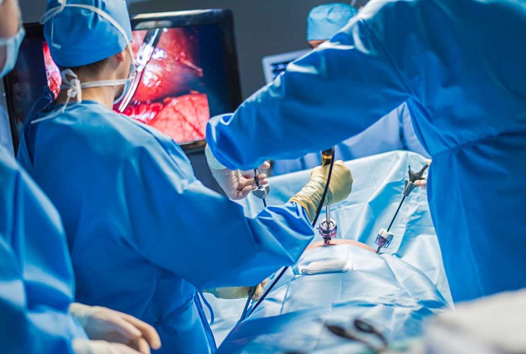 kidney transplant