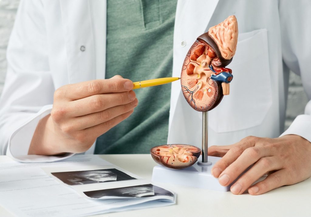 Uro Gynecology Diseases