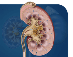 Urological Stone Management